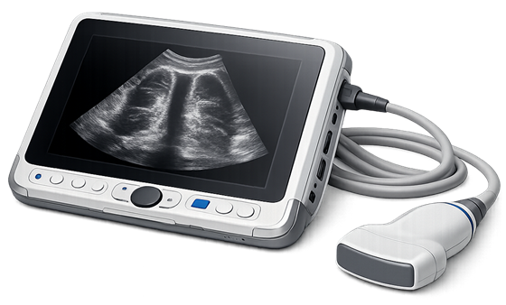 Ecógrafo portátil de point-of-care con su sonda